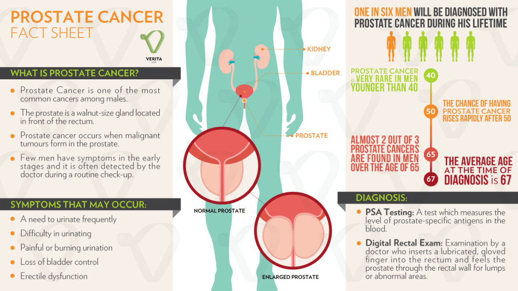 Como evitar el cancer de prostata